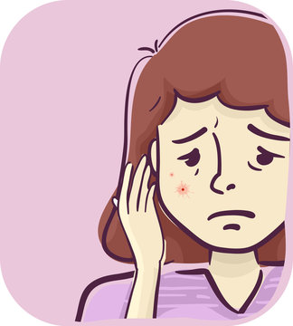 Girl Symptoms Red Spot Vein Mole Face Illustration
