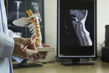 A neurosurgeon pointing at cervical spine model