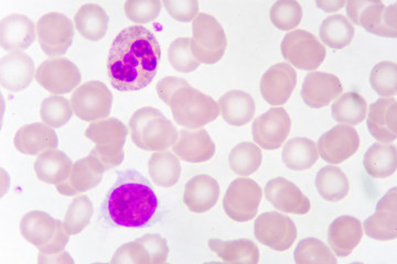 White blood cell in blood smear, analyze by microscope
