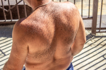 Hairy men back 