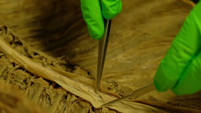 Closeup shot of the insides of a formaldehyde body with specialist pointing out parts in 4K
