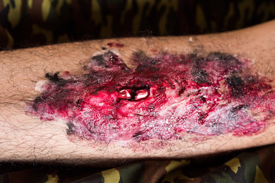 Fake wound on the leg, wound makeup special effect, selective focus, abstract blur background, shallow depth of field
