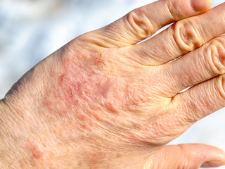 Detailed closeup of dry mature woman hand