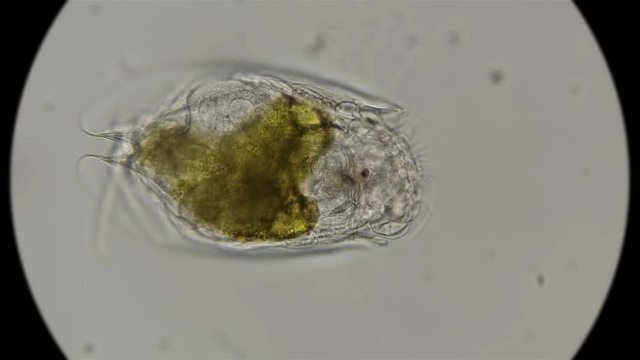 rotifer Epiphanes senta under a microscope