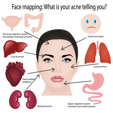 Face Mapping. What Your Acne Telling You Info-graphic