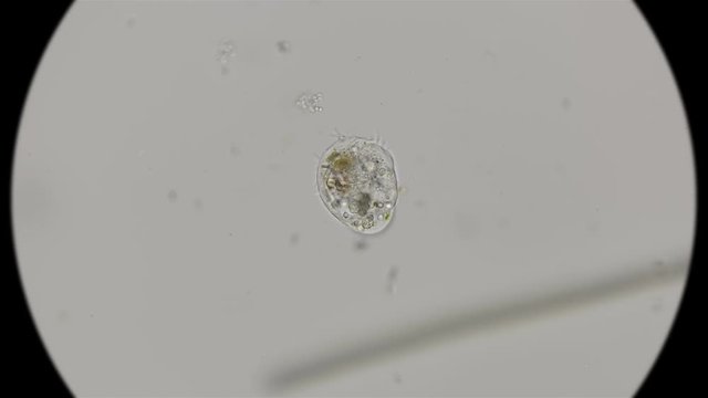 Testate amoeba under a microscope