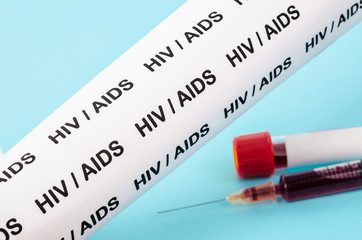 HIV test concept.