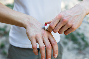 applying an cream emollient to dry flaky skin as in the treatment of psoriasis, eczema and other...