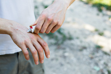 applying an cream emollient to dry flaky skin as in the treatment of psoriasis, eczema and other dry skin conditions