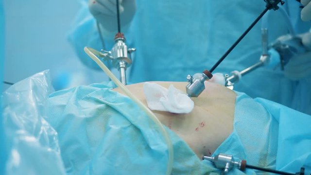 Close up of patient's abdomen during operation