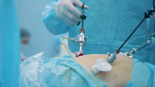 Doctors are carrying out an endoscopic operation