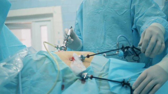 Doctor is dismantling surgical rod during laparoscopy
