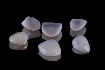 dental crowns and veneers