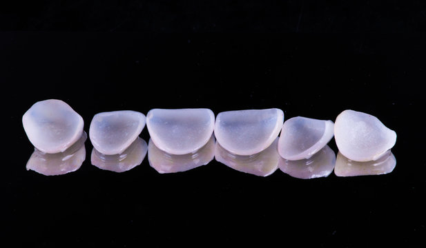 dental crowns and veneers