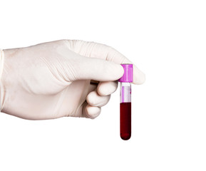 hand holding collection blood specimen isolated on white background