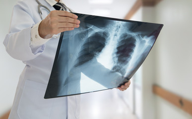 Doctor examining lung x-ray film