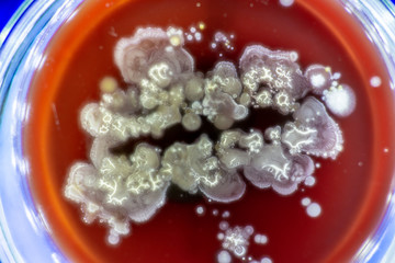Mold growing in a Petri dish