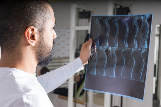 Doctor analysing X-ray image of spine