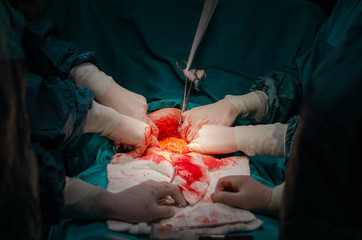 Team surgeon at work in operating room.