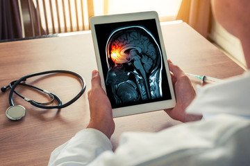 Doctor holding a digital tablet with x-ray of brain and skull skeleton. Headache, meningitis and migraine concept - obrazy, fototapety, plakaty
