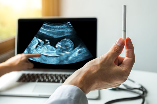 Doctor holding a cigarette and showing scan of new born fetus. Healthcare of baby during pregnancy concept