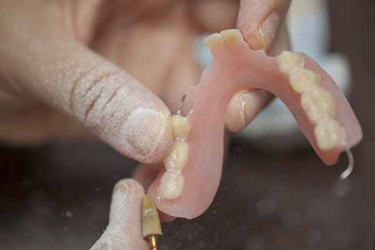 Dental technician work on denture prothesis in dental laboratory