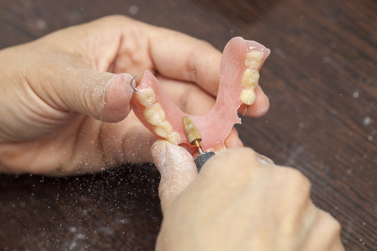 Hands of dental technician make denture prothesis in dental laboratory
