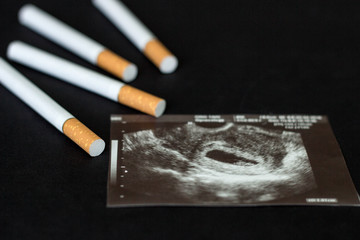 Cigarettes in the picture of pregnancy, pregnancy and smoking, cigarette