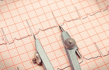 Electrocardiogram graph report with calipers, health care and medicine concept