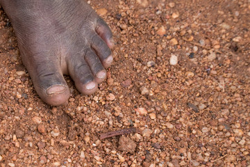 Poverty Child Feet in Africa