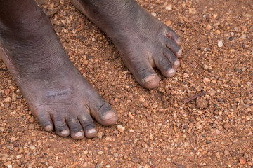 Poverty Child Feet in Africa