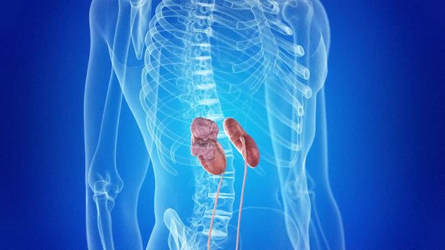medical 3d animation of kidney cancer