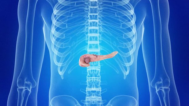 medical 3d animation of a pancreas tumor