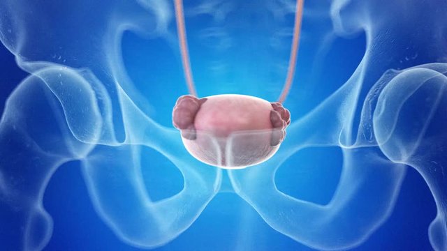 medically accurate 3d animation of bladder cancer