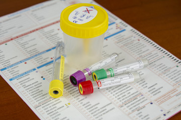 varios tubos para muestras de sangre y orina sobre informe medico