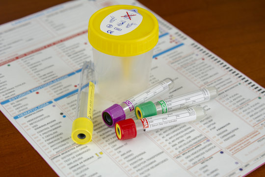 varios tubos para muestras de sangre y orina sobre informe medico