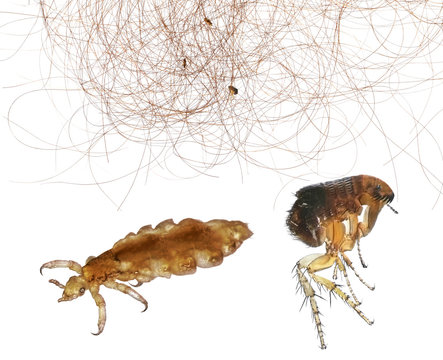 Human hair lice top