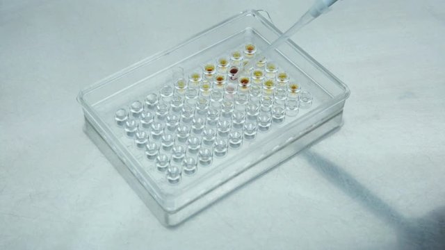 Conducting a reaction to the presence of the virus. Chemical reaction of staining. Appearance of the color in the sample when adding the reagent. Analysis for doping in athletes.