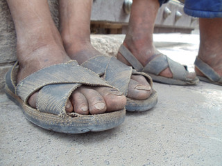 pies andinos con sandalias