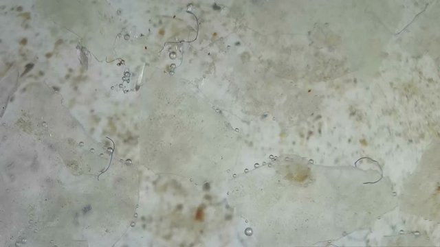 Synthetic nylon and plastic fibers released as deteriorating microscopic plastic floating and moving. The plastic damages the stomach of fish and seafood