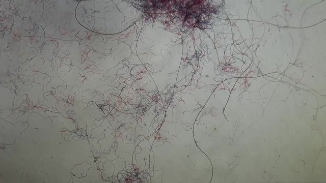 Synthetic fibers released from fabrics clothing in the form of microscopic plastic fibers every time we wash our laundry. The fibers damage the stomach of fish and seafood