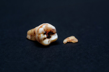 Broken Caries Molar on the iSolated Black Background