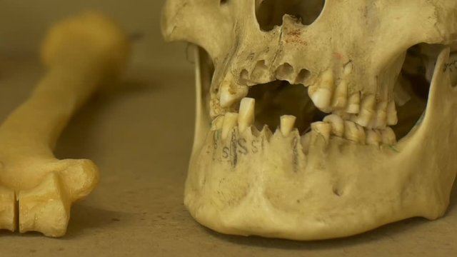 Ancient human skull teeth exposed in a laboratory.