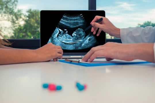 Doctor showing a scan of fetus on a laptop to a woman patient. Healthcare about baby during pregnancy concept. Pills or drugs on the desk