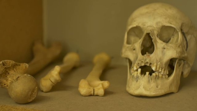 View of ancient human skull and bones.