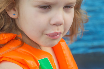  child the bite of a bee in the lip, swollen