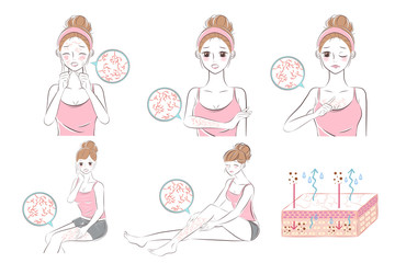 woman with dry skin concept