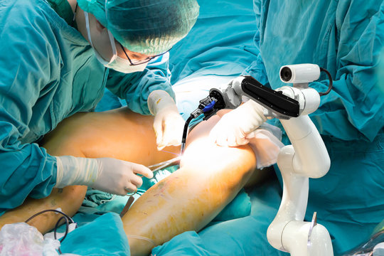Medical robot arm of the future, human replacement.