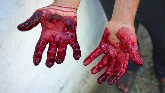 Bloody hands, close-up. Male hands are stained with blood