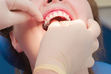 Adult woman visiting a dentist office. Dental hygienist's hands in rubber protective gloves using...